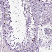 Anti-PLK5 antibody produced in rabbit 