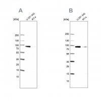 Anti-PLOD1 antibody produced in rabbit HPA049137-100UL