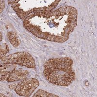 Anti-PLS3 antibody produced in rabbit 