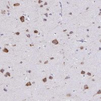 Anti-PLXNB3 antibody produced in rabbit 