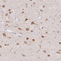 Anti-PNMAL2 antibody produced in rabbit 