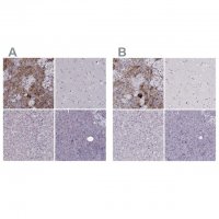Anti-PNMT antibody produced in rabbit 