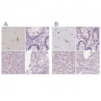 Anti-PNOC antibody produced in rabbit 