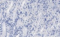 Anti-PNPT1 Antibody, clone 2D23 ZooMAb Rabbit Monoclonal 