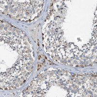 Anti-POC1A antibody produced in rabbit 