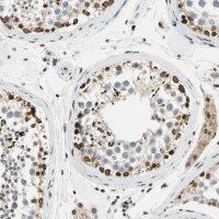 Anti-POGZ antibody produced in rabbit 