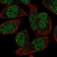 Anti-POLK antibody produced in rabbit 