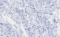 Anti-POLR2A Antibody, clone 3G21 ZooMAb Rabbit Monoclonal 