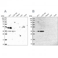 Anti-POLR2C antibody produced in rabbit HPA040919-100UL