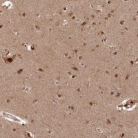 Anti-POLR3A antibody produced in rabbit 
