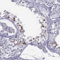 Anti-POM121L12 antibody produced in rabbit 