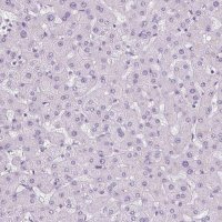 Anti-POPDC2 antibody produced in rabbit 