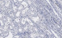 Anti-PP2A C subunit Antibody, clone 2B15 ZooMAb Rabbit Monoclonal 