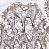 Anti-PPA2 antibody produced in rabbit 