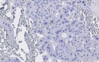 Anti-PPAR Antibody, clone 1I19 ZooMAb Rabbit Monoclonal 
