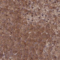 Anti-PPCDC antibody produced in rabbit 