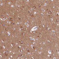 Anti-PPFIA3 antibody produced in rabbit 