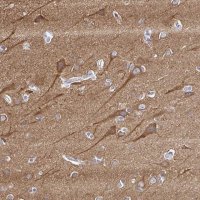 Anti-PPFIA4 antibody produced in rabbit 