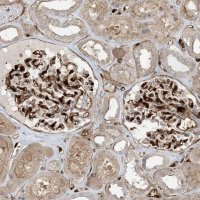 Anti-PPM1F antibody produced in rabbit 