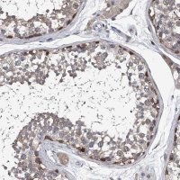 Anti-PPP2R5D antibody produced in rabbit 