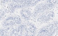 Anti-PPP3CC Antibody, clone 2C2 ZooMAb Rabbit Monoclonal 