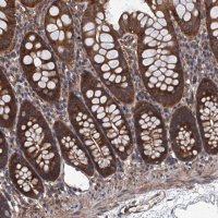 Anti-PPP4R1 antibody produced in rabbit 