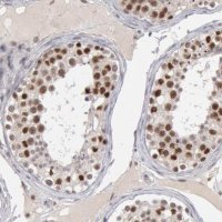 Anti-PPP4R3B antibody produced in rabbit HPA001233-100UL