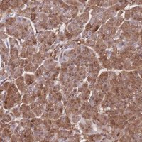 Anti-PPP6R3 antibody produced in rabbit 