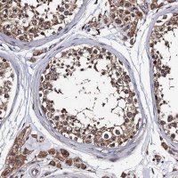 Anti-PPTC7 antibody produced in rabbit 