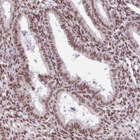 Anti-PRDM5 antibody produced in rabbit 