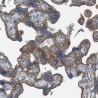 Anti-PREX2 antibody produced in rabbit 