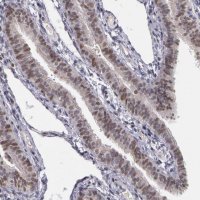 Anti-PRICKLE1 antibody produced in rabbit 