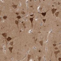 Anti-PRKAR1B antibody produced in rabbit 