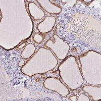 Anti-PRKCSH antibody produced in rabbit 