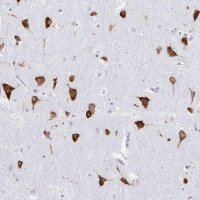 Anti-PRKRA antibody produced in rabbit 