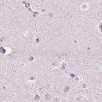 Anti-PRL antibody produced in rabbit 