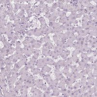 Anti-PRM1 antibody produced in rabbit 