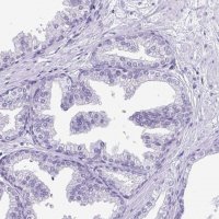 Anti-PRM2 antibody produced in rabbit 