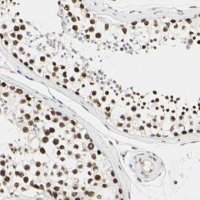 Anti-PRMT3 antibody produced in rabbit HPA007832-100UL