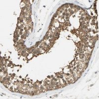 Anti-PRMT5 antibody produced in rabbit 