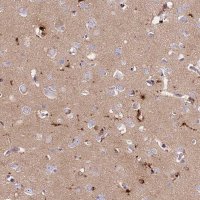 Anti-PRNP antibody produced in rabbit 