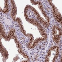 Anti-PRPF6 antibody produced in rabbit 