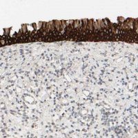 Anti-PRR11 antibody produced in rabbit 