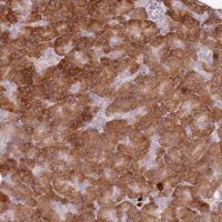 Anti-PRSS42 antibody produced in rabbit HPA046925-100UL