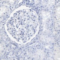 Anti-PSD3 antibody produced in rabbit 