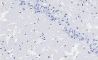 Anti-PSD95 Antibody, clone K28/43 ZooMAb Mouse Monoclonal 