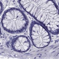 Anti-PSMB11 antibody produced in rabbit 