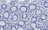 Anti-PSMB2 Antibody, clone 2N18 ZooMAb Rabbit Monoclonal 