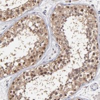 Anti-PSMD10 antibody produced in rabbit 
