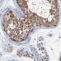 Anti-PSMD13 antibody produced in rabbit 